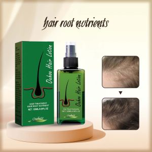 Ouhoe Ginger Hair Growth Spray Anti Hair Loss Treatment Scalp Prevent Alopecia Dry Hair Scalp Refreshing Nourish Hair Roots Gentle Moisturize Hair Denser Hair Care 120ml