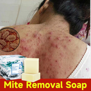 100g Sea Salt Soap Lightening - Sabun Awet Muda/ Anti Jerawat/ Glowing/ Pemutih/ Praktis/ shrinks pores whitens and removes blackheads 100% Original Removal Pimple Pores Acne Treatment Moisturizing Face Body Wash Soap Skin Care