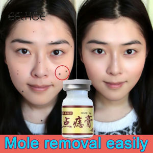 chấm rụng tẩy không sẹo kèm giấy hướng dẫn Kem Không Dấu Vết Loại Bỏ Flat Eugene Mượt Nhọn Thịt Gai