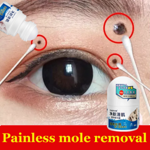 7 days Removes mole essence Whitening Dark Spot Freckle Facial Skin Care Serum 无痛无痕去痣 Highly effective skin lightening serum Skin tag remover Mole remover Mole lightening Facial skin care serum 30ml