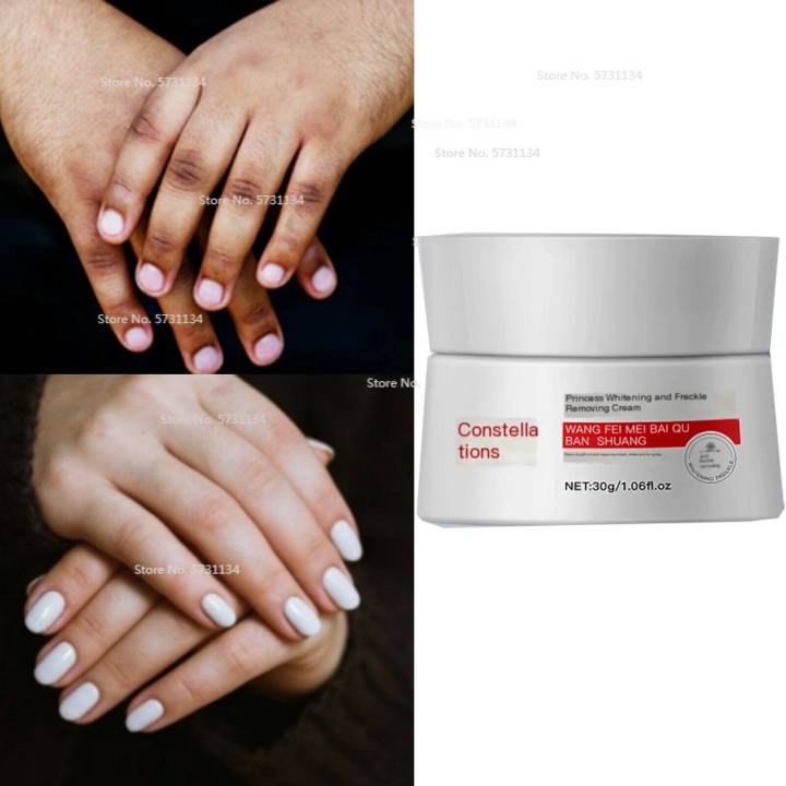 Dark Knuckles Remover Eraser, Clear Knuckles Cream for Hands Fingers