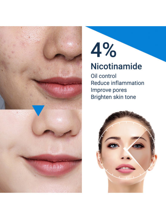 Cerave%20AM/PM%20Facial%20%E0%B9%82%E0%B8%A5%E0%B8%8A%E0%B8%B1%E0%B9%88%E0%B8%99%E0%B8%9A%E0%B8%B3%E0%B8%A3%E0%B8%B8%E0%B8%87%E0%B8%9C%E0%B8%B4%E0%B8%A7%20Moisturizing%20lotion%2089ml%20-%20Image%206