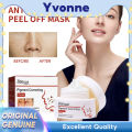 EELHOE Pigment Correcting Cream Freckles Removal Cream Pigment Correcting Serum Remove Melasma Age Spots Sunspots Whitening Freckle Removing Cream Effective Brightening Essence Remove Pigment Melanin Correct Beauty Facial Skin Care. 