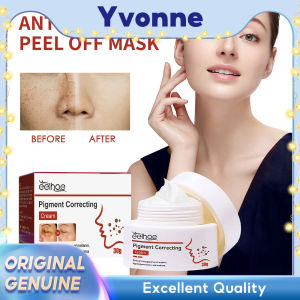 EELHOE Pigment Correcting Cream Freckles Removal Cream Pigment Correcting Serum Remove Melasma Age Spots Sunspots Whitening Freckle Removing Cream Effective Brightening Essence Remove Pigment Melanin Correct Beauty Facial Skin Care