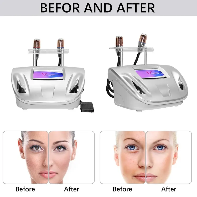 Portable 2 handle Vmax Hifu Machine Face Body Beauty Equipment