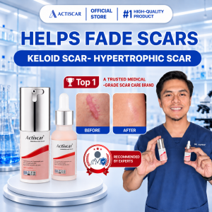 Scar removal cream Actiscar 20ml fading long-standing keloid scars