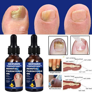 Serum ngăn ngừa nấm móng tay chân phục hồi móng thối móng hư móng