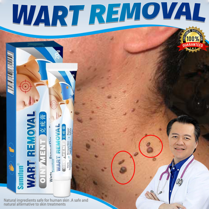warts remover original watson removal ointment cream original skin tags