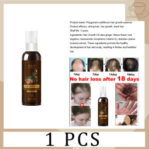 hair growth serum anti hair loss tonic 100ml minoxidil 5 hair growth Hair Growth Supplement Men And Women Anti Hair Loss Prevent Baldness Treatment