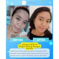 HARUKA Skincare untuk Kulit Flek - Haruka Skincare Official. 