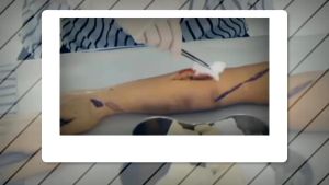 Kasa Lipat Medis Steril Pouch Kain Perban Luka Ukuran 10x10 CM