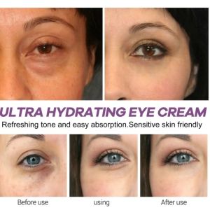 new ﻿ Eye Bag Remove Peptides Retinal Eye Cream Target Dark Circles and Puffiness Under Eye Gel Hydrating Korean Beauty Eye Care hot