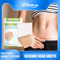 JKS（4*150cm）South Moon Silicone Scar Sheet High Efficiency Surgical Silicone Gel Tape Removal Scar Tape Treatment. 