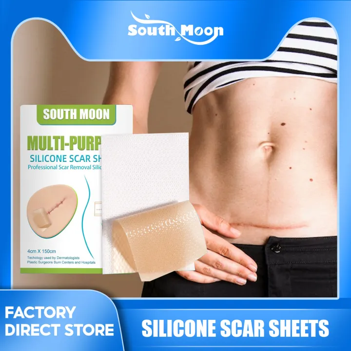 JKS%EF%BC%884*150cm%EF%BC%89South%20Moon%20Silicone%20Scar%20Sheet%20High%20Efficiency%20Surgical%20Silicone%20Gel%20Tape%20Removal%20Scar%20Tape%20Treatment%20-%20Image%2010