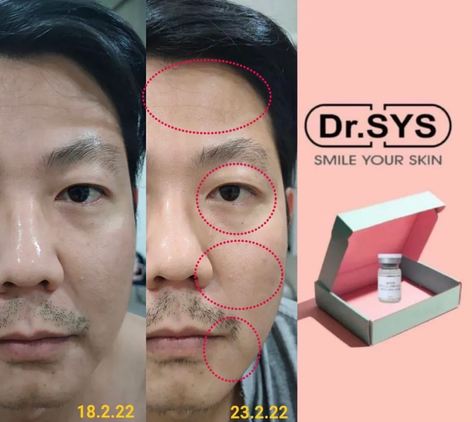 DR.SYS PS Stem Cell Ampoule - Lazada | Lazada