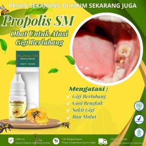 Propolis Sm - Obat Gigi Berlubang Obat Gigi Nyutnyutan Obat Gusi Bengkak Penghilang Bau Mulut