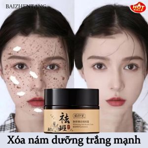 Efektif Whitening Freckle Cream Menghapus Melasma Jerawat Bintik Gelap Pigmentasi Kulit Kulit 30g