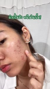 VICHY Normaderm BHA Peeling Serum  20ML