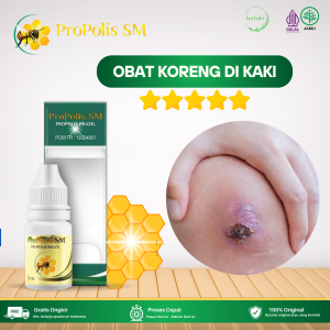 Obat Koreng Di Kaki Obat Koreng Bernanah Obat Penghilang Bekas Koreng Obat Koreng Gatal Obat Koreng Menahun Obat Koreng Di Kaki Obat Scabies Manusia Dengan Propolis SM