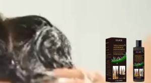 Eelhoe Skin Tinea Head Anti-Itching Shampoo Anti-Refreshing Oil Control Hair Care Anti-Dandruff Anti-Itching Shampoo