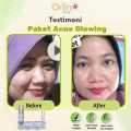 Orlin Beauty Paket Acne Glowing Platinum 4in1 Mencerahkan Wajah Kulit Sensitif Bekas Jerawat Flek Hitam Skincare BPOM. 
