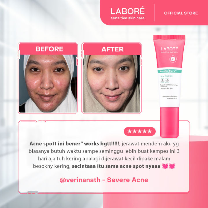 %5BGift%20Not%20For%20Sale%5D%20LABORE%20Sensitive%20Skin%20Care%20Acne%20Spot%20Gel%2015%20ml%20-%20Image%203
