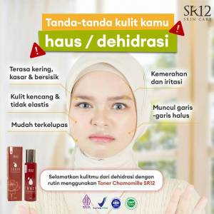 Toner Chamomile SR12 BPOM - Toner Wajah Membantu Membersihkan & Menyegarkan Kulit Wajah