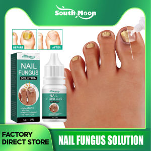 Eelhoe Nail Fungus Solution Nail Fungus Treatment Essence Serum Hand Care Foot Fungal Removal Repair Gel Anti-infective Paronychia Onychomycosis Nail Repair Liquid Nails Solution Fungal Nail Antifungal Anti Fungus Toe Nail Care Hand And Foot Onychomycosis