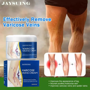 Kem Thảo Dược Hỗ Trợ Giảm Giãn Tĩnh Mạch Chống Giãn Tĩnh Mạch Làm Dịu Chân