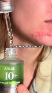 offical promotion Anua 10% Azelaic Acid Serum 30ml Brightening Soothing Hydrating Calming Repair