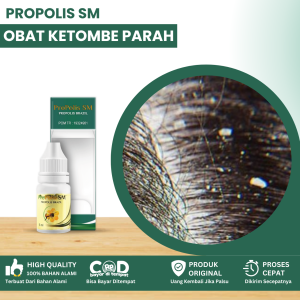 Obat Ketombe Parah Obat Ketombe Membandel Obat Kulit Kepala Berkerak Obat Ketombe Kering Obat Psoriasis Kepala Eksim Kulit Kepala Obat Ketombe Berkerak Di Kulit Kepala Obat Ketombe Basah Dan Bau Dengan Propolis SM