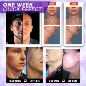 Facial muscle trainer exercises jaw exercise face  silicone neck muscle trainer