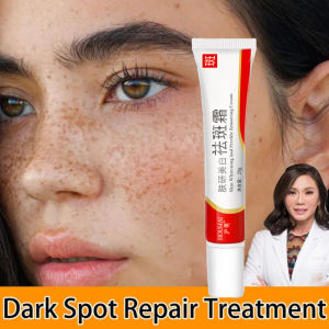 Effective Freckle Cream-Remove Dark Spots Witening Cream- Whitening Freckle Cream -Remove Dark Spots - Penghilang Flek/Jerawat/Bintik Noda Hitam Komedo