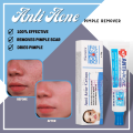 Anti Acne Cream Pimple Scars Remover For All Skin Types 100% Facial Solution Effective Treats Acne Remove Blemish Surgery Scars Acne Breakouts Treatment For Acne Problem Natural Ingredients Extract Best Acne Remover. 