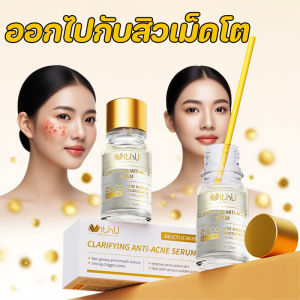 Yipaidsor  เซรั่มกำจัดสิว WithUpure Anti Acne Lotion ของแท้ 10/20/30ml ลดการอักเสบ ที่ช่วยลดรูขุมขนและสิว อ่อนโยนต่อผิว