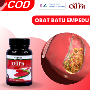Obat Batu Empedu Obat Radang Empedu Infeksi Saluran Empedu Obat Penyumbatan Di Saluran Empedu Kolelitiasis Obat Kencing Batu Saluran Empedu Tersumbat Obat Penghancur Batu Empedu Obat Sakit Kencing Obat Radang Kantung Empedu Dengan OilFit
