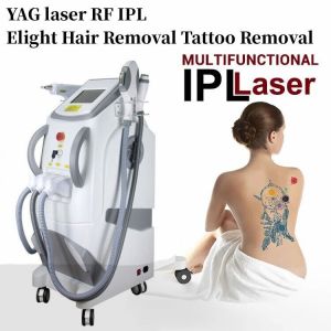 ND Yag Laser Tattoo Removal SHR IPL OPT Hair Removal Machine and Skin Treatment