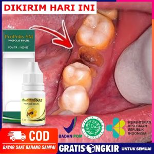 Obat Gusi Bengkak Nyeri Gigi Berlubang Goyang Obat Sakit Gigi Berlubang Herbal Obat Akar Gigi Penghilang Sisa Gigi Berlubang