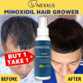 NEXXUS Minoxidil Hair Grower For Men/ Women Minoxidil Strands 6% Hair Growth Topical Solution Ginger Extract 60ml. 