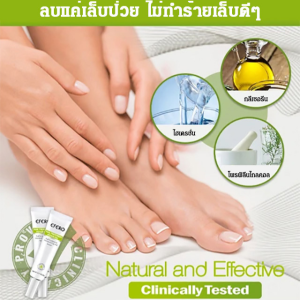 ครีมซ่อมแซมเล็บ ช่วยบำรุงและป้องกันเล็บแตก ทำให้เล็บสวยและแข็งแรง