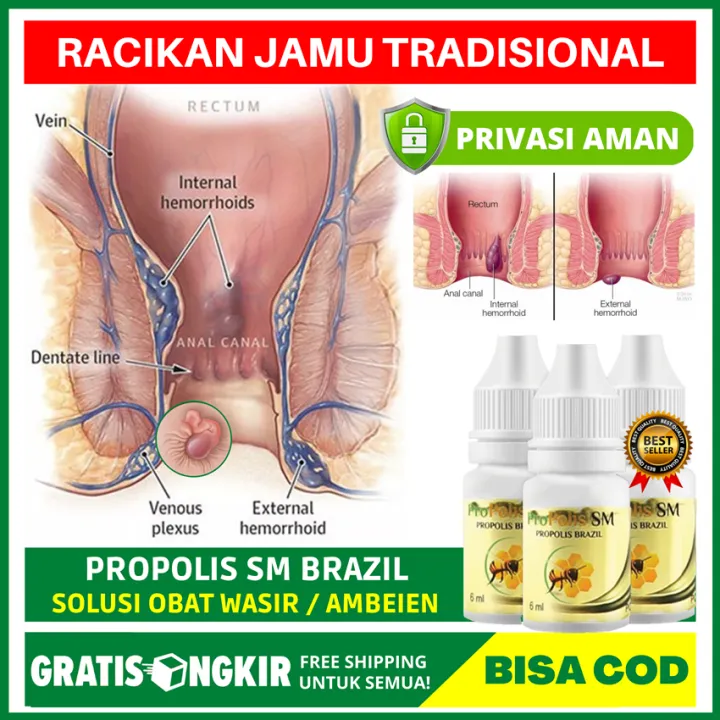 Keksa ayollarda anus Keksa ayollarda anus