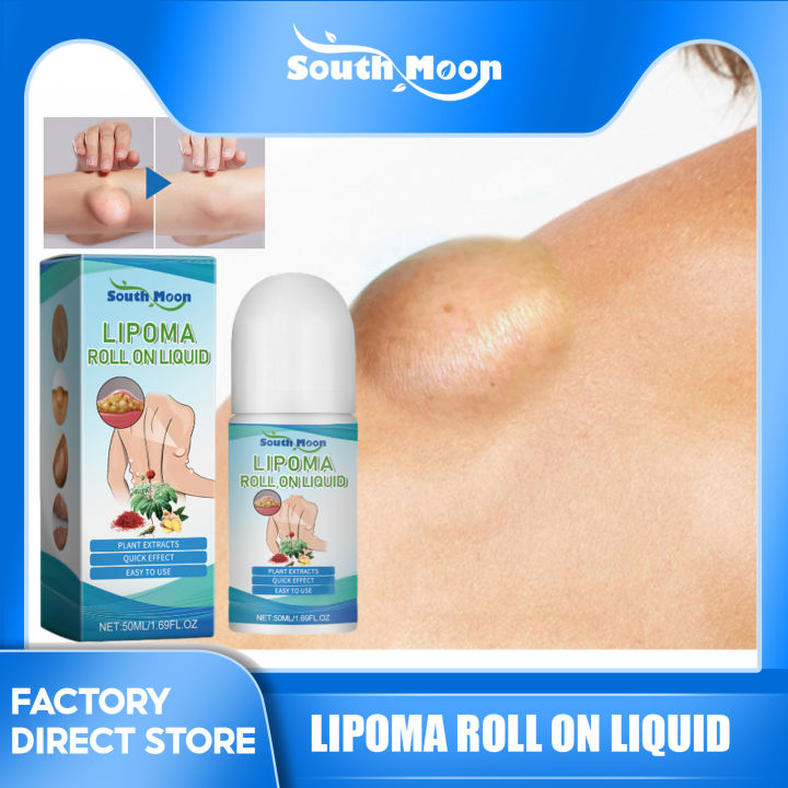 Liquid Go Lumpy South Moon Lipoma Roll On Liquid Fibroma Cellulite Remover Apply To ...