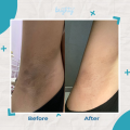 Brighty Underarm Scrub Microscrub Pencerah Ketiak - Mencerahkan Kulit (Bpom). 