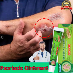 [Chính Hãng SUMIFUN] Kem bôi vẩy nến viêm da kháng khuẩn đánh bay nấm da chống ngứa viêm da hắc lào lang ben mề đay viêm da cơ địa á sừng vảy nến tổ đỉa viêm da dầu viêm da dị ứng