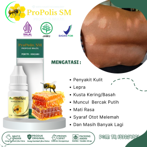 Obat Lepra Kusta Kering/Basah Muncul Bercak Putih luka Kulit Menebal Kering Mati Rasa Pada Tungkai Dan Kaki Syaraf Otot Melemah Infeksi Kulit Bakteri Kronis Dengan ProPolis SM