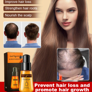 Hair Growth Liquid Dense Hair Scalp Essence Hairline Nourishing Care Men S and Women S Hair Solid Oil Nutrient Solution精华生发油