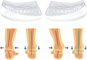 Skyfoot Heel Wedge Inserts for Supination & Pronation Correction Adhesive Medial & Lateral Heel Insoles for Bow Legs Knee Pain Foot Alignment (L: W 7-11 M 7-10 Crystal - 1 Layer)