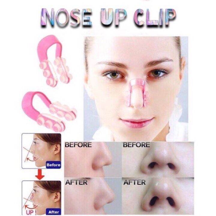 Nose Up Nose Lifter Clip | Lazada PH