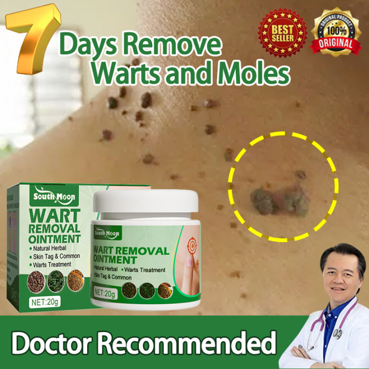 🔥Effective in 5 days🔥Warts Skin Tags And Mole Remover Original Cream ...