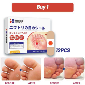 Ready Stock Japan Wart Removal Patch Foot Corn Remover Corn Plaster Removal of Warts on Hands and Feet Skin Tag 鸡眼贴/足部护理贴 COD